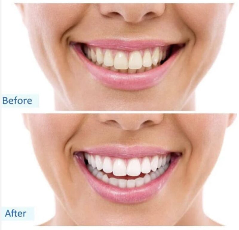 Pepsodent Complete Care Toothpaste Original Flavor 5. 5 oz ( Pack of 24) - Image 2