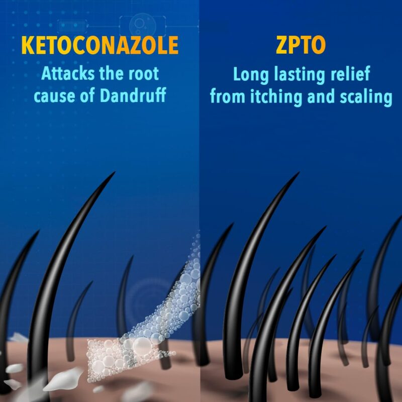 Scalpe+ Expert - Bottle of 75ml Anti Dandruff Shampoo for Men and Women with Ketoconazole and ZPTO - Image 5